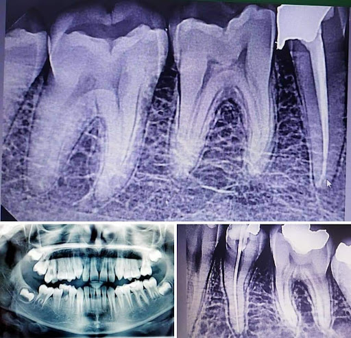 Dar Edku Scan Center مركز دار إدكو للأشعة
