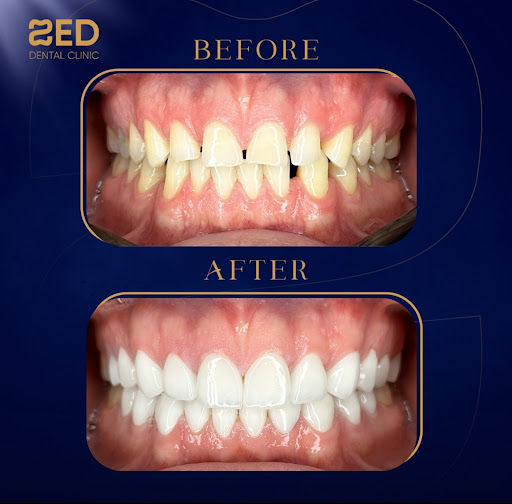 ZED DENTAL CLINIC