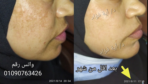 عيادة دكتورة آية فؤاد .. الجلدية والتجميل