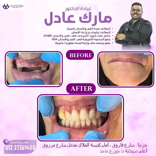 Mark clinic عيادة دكتور مارك عادل لجميع خدمات الاسنان