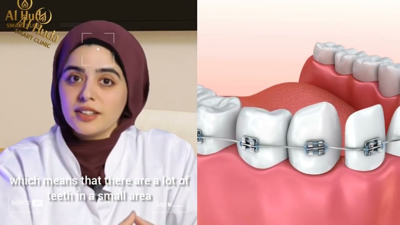 رأي حقيقي حول عيادات الهدى سمارت كلينك: تجربة المرضى وأفضل الخدمات الطبية