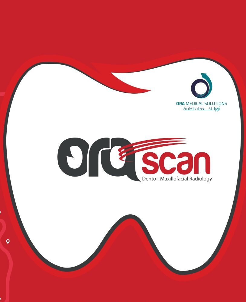 رأي حول ORASCAN: تقييم شامل لمزايا وعيوب جهاز المسح الضوئي وأدائه