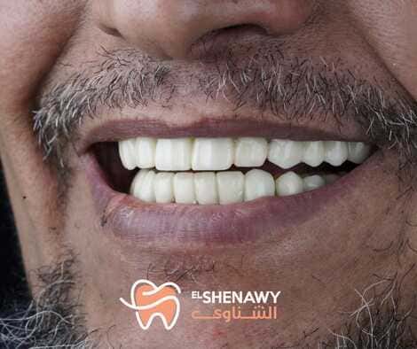 رأي حول عياده العباسي لطب وجراحه وتقويم الفم والاسنان 1 عيادة العباسي لطب الأسنان: تقييم شامل لخدمات العلاج والتقويم والجراحة