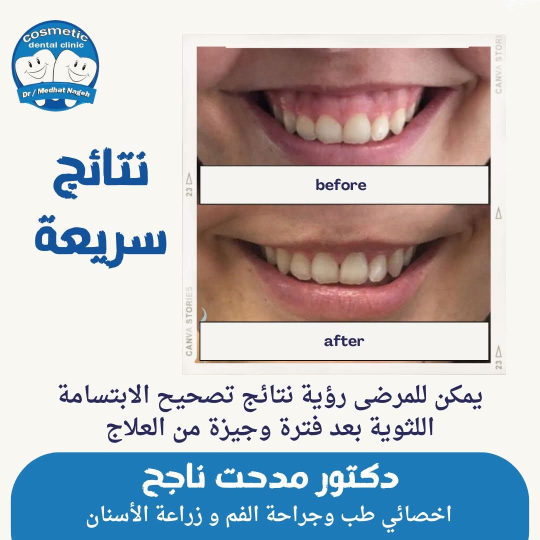 رأي حول عيادة الدكتور/ مدحت ناجح آدم لطب الاسنان 1 عيادة الدكتور مدحت ناجح آدم لطب الأسنان: تقييم شامل وتجربة المرضى