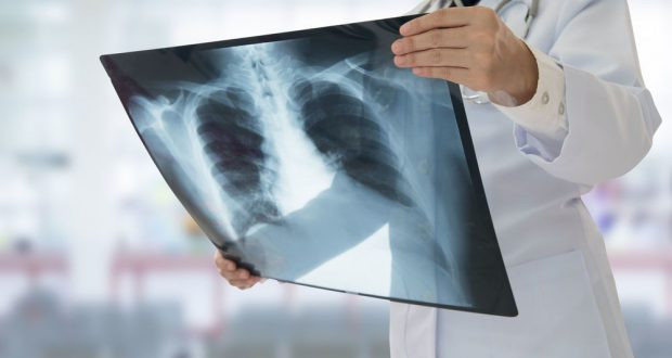 رأي حقيقي عن مركز طيبة للأشعة: دقة التشخيص، جودة الخدمة، والأسعار